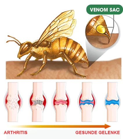 Seurico™ Bienenvenom Fortgeschrittene Gelenk- und Knochen-Therapiecreme