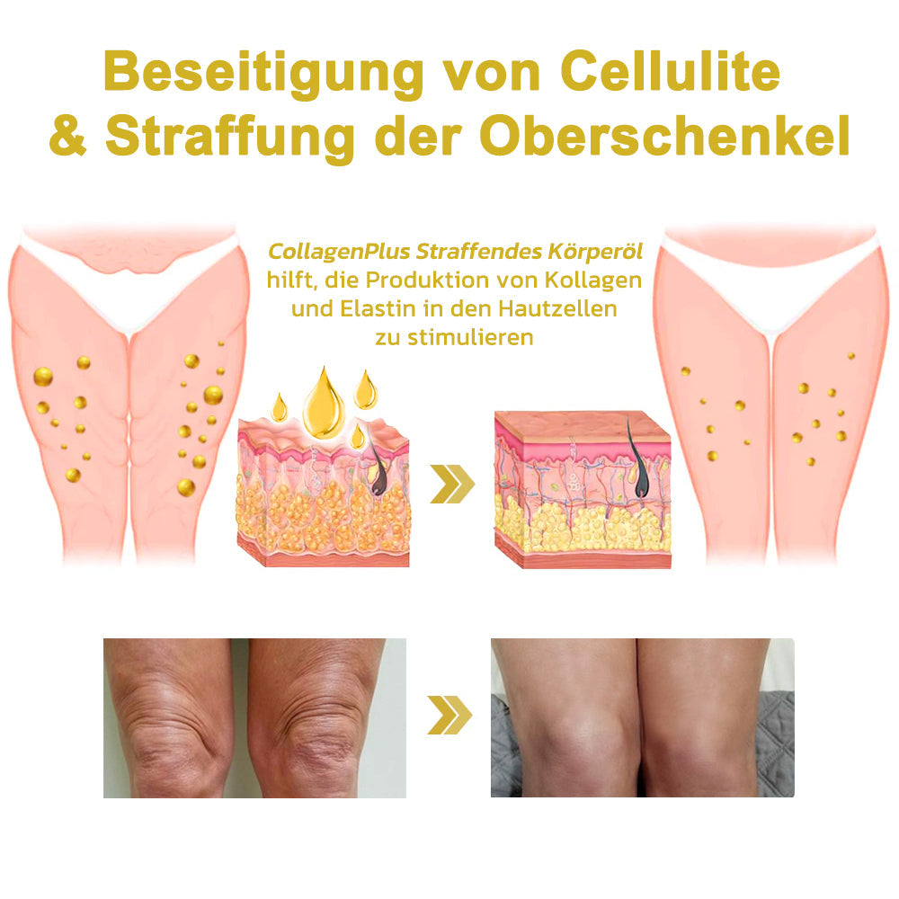 🌿💧Letzter Tag Rabatt : 𝟕5% RABATT🫧Fuzero™ Erweiterte straffende & faltenreduzierende Creme: Wiederherstellung der Elastizität der Haut🌐